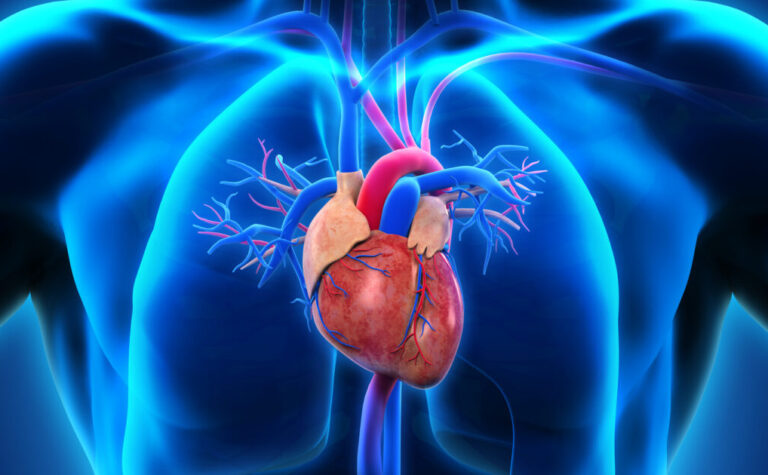 Coronary-heart-disease